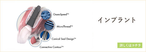 インプラント