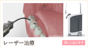 レーザー治療